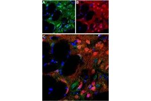 Expression of D5 dopamine receptor in rat striatum - Immunohistochemical staining of perfusion-fixed rat brain frozen using Anti-D5 Dopamine Receptor (extracellular) Antibody (ABIN7043111, ABIN7044234 and ABIN7044235), (1:100). (DRD5 抗体  (2nd Extracellular Loop))