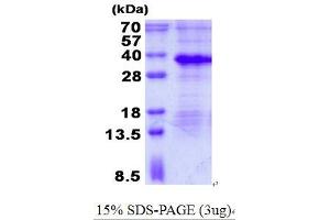 Image no. 1 for Microfibrillar Associated Protein 2 (MFAP2) (AA 18-183) protein (His tag) (ABIN1098693) (MFAP2 Protein (AA 18-183) (His tag))