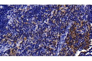 Immunohistochemistry (IHC) image for anti-Interleukin 1 Receptor Accessory Protein (IL1RAP) (AA 65-249) antibody (ABIN7436570)