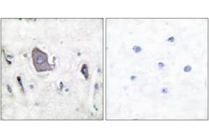 Immunohistochemistry analysis of paraffin-embedded human brain, using Trk B (Phospho-Tyr705) Antibody. (TRKB 抗体  (pTyr706))