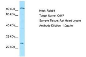 Image no. 1 for anti-Cadherin 7 (CDH7) (AA 51-100) antibody (ABIN6749910) (Cadherin 7 抗体  (AA 51-100))