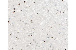 ABIN6266815 at 1/100 staining human brain tissue sections by IHC-P. (THRB 抗体  (Internal Region))