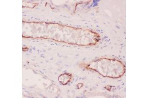 Anti-ACE Picoband antibody,  IHC(P): Human Placenta Tissue