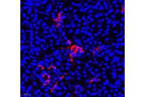 Immunofluorescence (Paraffin-embedded Sections) (IF (p)) image for anti-Aldehyde Dehydrogenase 4 Family, Member A1 (ALDH4A1) antibody (ABIN7073000)