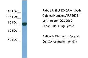 WB Suggested Anti-UNC45A  Antibody Titration: 0. (UNC45A 抗体  (N-Term))