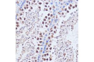Immunohistochemistry of paraffin-embedded mouse testis using BRD4 antibody (ABIN6127508, ABIN6137653, ABIN6137654 and ABIN7101457) at dilution of 1:100 (40x lens). (BRD4 抗体  (AA 1100-1200))
