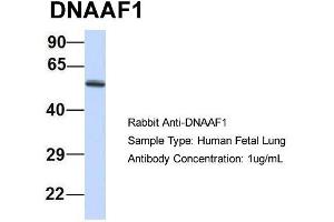 Host: Rabbit  Target Name: DNAAF1  Sample Tissue: Human Fetal Lung  Antibody Dilution: 1. (LRRC50 抗体  (N-Term))