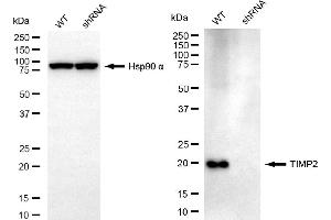 Western blotting analysis using TIMP2 antibody (ABIN7799377). (TIMP2 抗体)