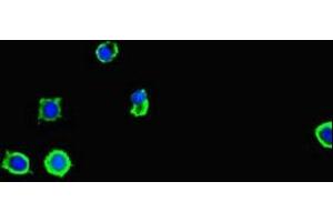 Immunofluorescence (IF) image for anti-Sequestosome 1 (SQSTM1) (AA 16-310) antibody (ABIN7168871)