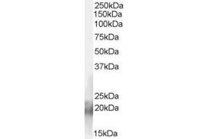 Western Blotting (WB) image for anti-CCHC-Type Zinc Finger, Nucleic Acid Binding Protein (CNBP) (C-Term) antibody (ABIN185618)
