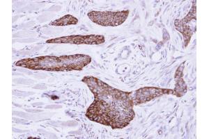 IHC-P Image Immunohistochemical analysis of paraffin-embedded H661 xenograft, using MCD, antibody at 1:500 dilution. (MLYCD 抗体)
