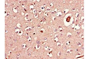 Immunohistochemistry of paraffin-embedded human brain tissue using ABIN7143254 at dilution of 1:100 (Acylglycerol Kinase 抗体  (AA 32-65))