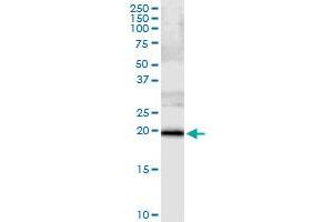 Immunoprecipitation of SSH2 transfected lysate using anti-SSH2 MaxPab rabbit polyclonal antibody and Protein A Magnetic Bead , and immunoblotted with SSH2 MaxPab mouse polyclonal antibody (B01) . (SSH2 抗体  (AA 1-178))
