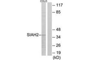 Western blot analysis of extracts from COLO cells, using SIAH2 Antibody. (SIAH2 抗体  (AA 241-290))