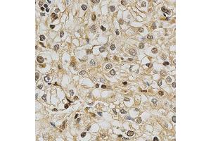 Immunohistochemistry (IHC) image for anti-Glutathione S-Transferase theta 1 (GSTT1) (AA 1-240) antibody (ABIN3021871)