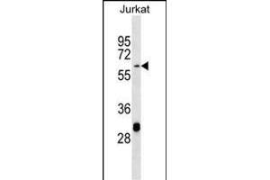 TN3 Antibody (Center) (ABIN656882 and ABIN2846082) western blot analysis in Jurkat cell line lysates (35 μg/lane).