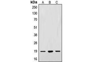 Western blot analysis of Alpha-synuclein expression in A549 (A), SKNSH (B), PC12 (C) whole cell lysates. (SNCA 抗体  (N-Term))