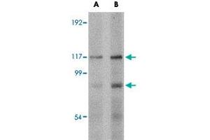 Western blot analysis of FNIP2 in rat skeletal muscle tissue lysate with FNIP2 polyclonal antibody  at (A) 1 and (B) 2 ug/mL . (FNIP2 抗体  (C-Term))