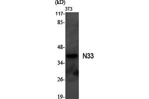 Western Blotting (WB) image for anti-Tumor Suppressor Candidate 3 (TUSC3) antibody (ABIN5961746) (TUSC3 抗体)