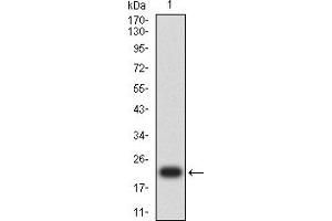 Western blot analysis using ACTH mAb against human ACTH recombinant protein. (ACTH 抗体)
