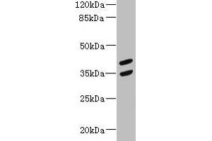 Western blot All lanes: MAGEB10 antibody at 12 μg/mL + Mouse heart tissue Secondary Goat polyclonal to rabbit IgG at 1/10000 dilution Predicted band size: 39 kDa Observed band size: 39, 35 kDa (MAGEB1 抗体  (AA 1-300))
