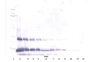 Image no. 1 for anti-Interleukin 15 (IL15) antibody (ABIN465267) (IL-15 抗体)