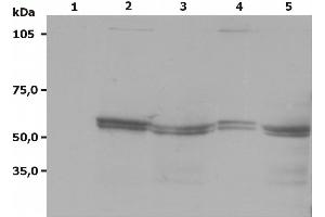 Western Blotting analysis (non-reducing conditions) of Lyn using anti-Lyn (LYN-01). (LYN 抗体  (AA 8-238))