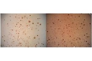 Immunohitsochemistry analysis of Amyloid Fibrils (OC) in Human AD brain, showing no Amyloid Precursor Protein (APP) cross-reactivity (Left), but when conducted with monoclonal 6E10 (Right) shows considerable APP cross-reactivity. (Amyloid Fibrils 抗体)