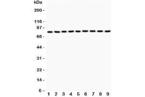 Western blot testing of Plakoglobin antibody and Lane 1:  rat brain;  2: (r) heart;  3: (r) thymus;  4: (r) RH35;  5: human HeLa;  6: (h) COLO320;  7: (h) HepG2;  8: mouse HepA;  9: (h) MCF-7. (JUP 抗体  (AA 556-745))