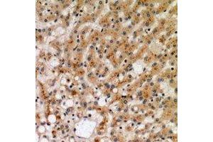 Immunohistochemical analysis of CD265 staining in human liver formalin fixed paraffin embedded tissue section. (TNFRSF11A 抗体  (N-Term))