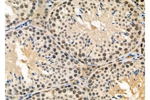ABIN6258658 and ABIN6274958 at 1/100 staining Mouse testis tissue by IHC-P. (CA13 抗体  (Internal Region))