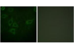 Immunofluorescence (IF) image for anti-Thymidine Kinase 1, Soluble (TK1) (AA 1-50) antibody (ABIN2888706) (TK1 抗体  (AA 1-50))