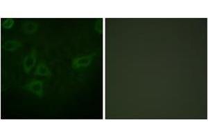 Immunofluorescence (IF) image for anti-Thymidine Kinase 1, Soluble (TK1) (AA 1-50) antibody (ABIN2888706) (TK1 抗体  (AA 1-50))