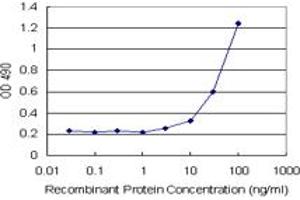 SERPINA3 (Human) Matched Antibody Pair