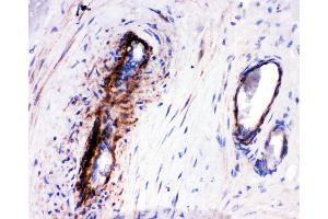 Anti-LASP1 antibody,  IHC(P) IHC(P): Human Placenta Tissue (LASP1 抗体  (N-Term))