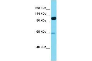 Western Blotting (WB) image for anti-Pitrilysin Metallopeptidase 1 (PITRM1) (N-Term) antibody (ABIN2784897)