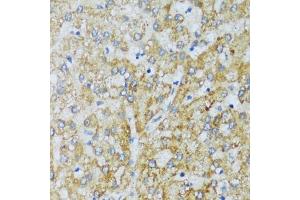 Immunohistochemistry of paraffin-embedded human liver using C1QC antibody (ABIN7266475) at dilution of 1:100 (40x lens). (C1QC 抗体  (AA 50-150))