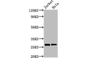 Western Blot Positive WB detected in: Jurkat whole cell lysate, Hela whole cell lysate All lanes: HSD17B10 antibody at 3 μg/mL Secondary Goat polyclonal to rabbit IgG at 1/50000 dilution Predicted band size: 27, 26 kDa Observed band size: 27 kDa (HSD17B1 抗体  (AA 2-261))