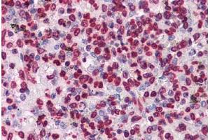 Human Spleen: Formalin-Fixed, Paraffin-Embedded (FFPE) (HIPK1 抗体  (AA 330-430))