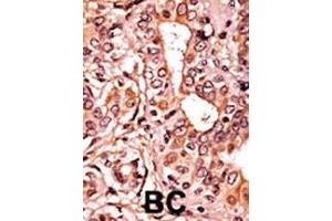 Immunohistochemistry (Paraffin-embedded Sections) (IHC (p)) image for anti-Cyclin-Dependent Kinase 7 (CDK7) (pThr170) antibody (ABIN389541)