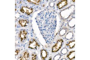 Immunohistochemistry of paraffin-embedded human kidney using [KO Validated]  Rabbit mAb  at dilution of 1:100 (40x lens). (ACE2 抗体)