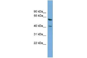 WB Suggested Anti-PINX1 Antibody Titration: 0. (PINX1 抗体  (Middle Region))