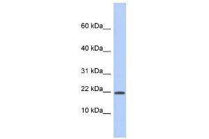 Western Blotting (WB) image for anti-Host Cell Factor C1 Regulator 1 (XPO1 Dependent) (HCFC1R1) (Middle Region) antibody (ABIN2786539)
