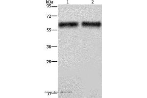 Western blot analysis of Human hepatocellular carcinoma tissue, using ELN Polyclonal Antibody at dilution of 1:400 (Elastin 抗体)