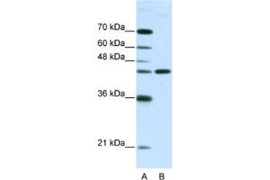 Western Blotting (WB) image for anti-Neuromedin U Receptor 2 (NMUR2) antibody (ABIN2461125) (NMUR2 抗体)