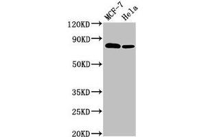 Western Blot Positive WB detected in: MCF-7 whole cell lysate, Hela whole cell lysate All lanes: BCAR1 antibody at 3. (BCAR1 抗体  (AA 68-218))