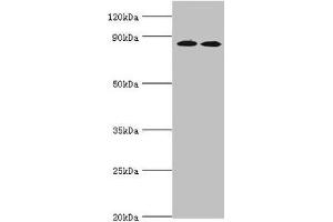 Western blot All lanes: AMP deaminase 3 antibody at 2 μg/mL Lane 1: NIH/3T3 whole cell lysate Lane 2: 293T whole cell lysate Lane 3: Mouse lung tissue Secondary Goat polyclonal to rabbit IgG at 1/10000 dilution Predicted band size: 89, 25, 77, 90, 72 kDa Observed band size: 89 kDa (AMPD3 抗体  (AA 1-260))