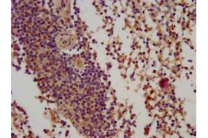 IHC image of ABIN7145780 diluted at 1:100 and staining in paraffin-embedded human spleen tissue performed on a Leica BondTM system. (BIN2 抗体  (AA 290-496))