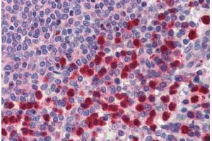 Human Spleen (formalin-fixed, paraffin-embedded) stained with TRIM35 antibody ABIN462195 followed by biotinylated goat anti-rabbit IgG secondary antibody ABIN481713, alkaline phosphatase-streptavidin and chromogen. (TRIM35 抗体  (AA 359-408))