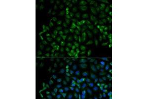 Immunofluorescence analysis of HeLa cells using Beta-TRCP Polyclonal Antibody (beta-TrCP 抗体)